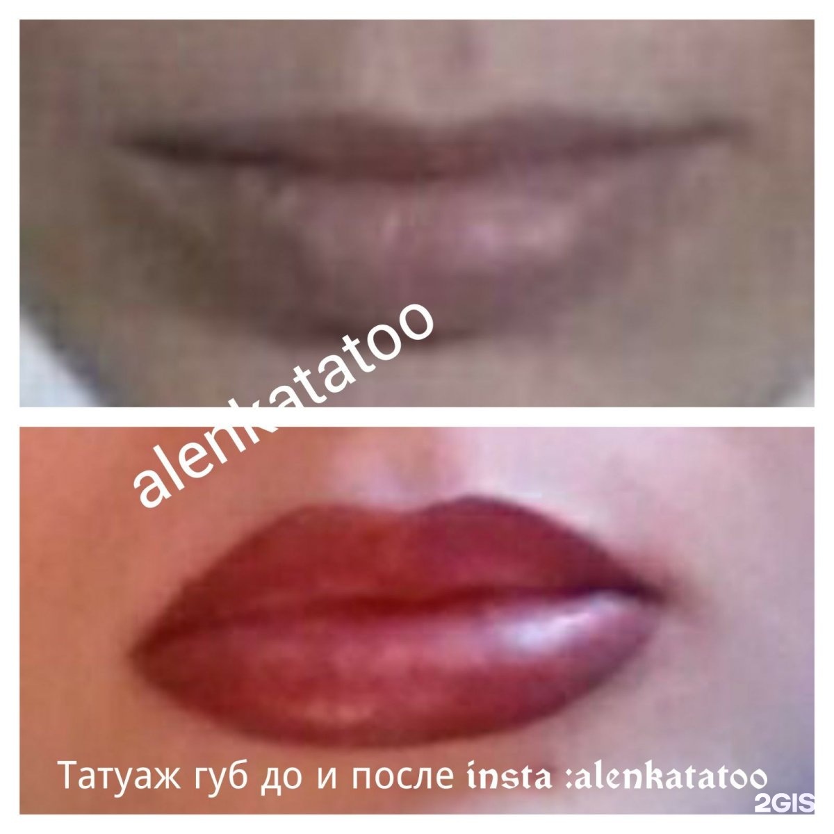 Губы татуаж осложнения Губы татуаж осложнения