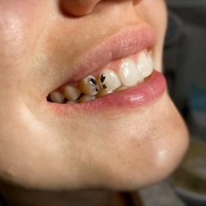 Фото от владельца ГалаДентис, стоматологический центр