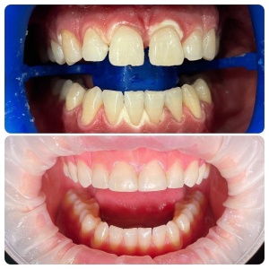 Фото от владельца Smile Like, стоматологическая клиника