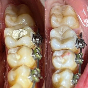 Фото от владельца ЭллаСтом, стоматологическая клиника