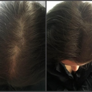 Фото от владельца Hair Clinic, клиника здоровья волос