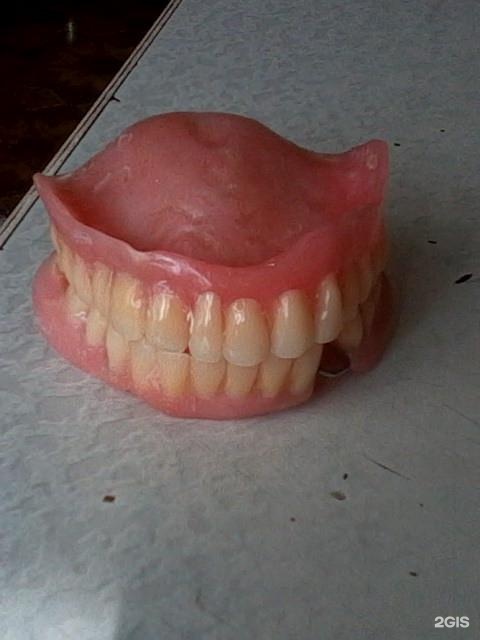Завьялова стоматология. Стоматология 3 Барнаул. Лишний зуб в верхней челюсти.